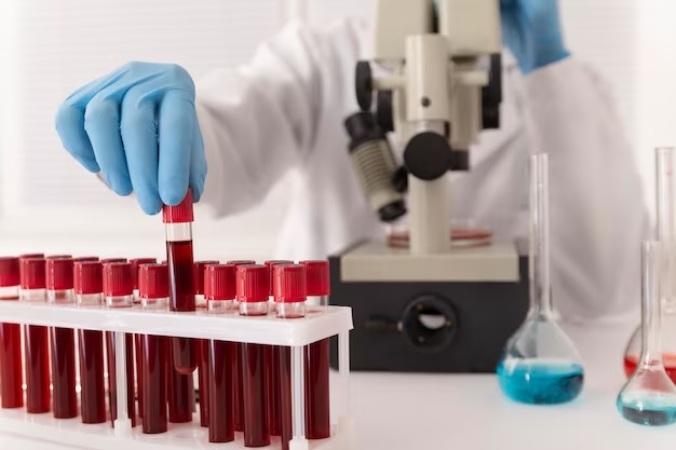 blood-culture-test-market