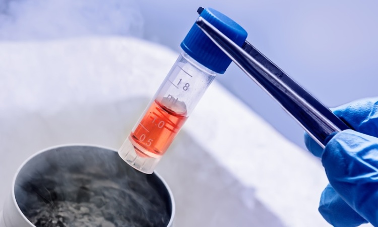 cell-cryopreservation-market