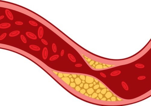 cholesterol-market