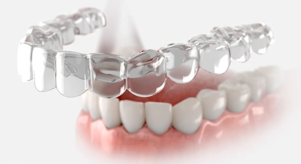 dental-aligners-market